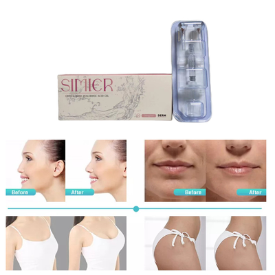 2 ml Çapraz Bağlı Dermal Dolgu Yüksek Ha Konsantrasyonu 24mg/Ml kırışıklıklara karşı