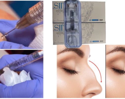 Hyaluronik Asit Yüz Enjeksiyon Dudak Dermal Filler Ce MSDS ISO