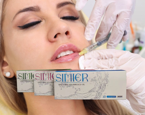 Dolgular Hyaluronik Asit Jeli 5ml Dudak Dermal Dolgu Enjeksiyonlar Enjekte edilebilir Dermal Dolgu