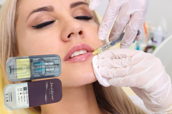 Dolgular Hyaluronik Asit Jeli 5ml Dudak Dermal Dolgu Enjeksiyonlar Enjekte edilebilir Dermal Dolgu
