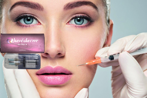 1 ml Juvederm Medical Sodium Hyaluronate Gel Hidaluronik Asit Gel Injeksiyon Burnun Köprüsü için