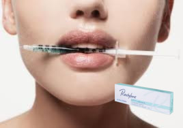 27G Marionette Lines Hyaluronik Asit Dolgu 1ml Lido ile derin hat dolguları