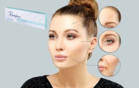 Hyaluronik Asit Dermal Filler 1x1.1ml Dudak Filler