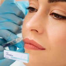 Hyaluronik Asit Enjekte edilebilir Dermal Doldurucu Dudak Enjekte edilebilir Gel