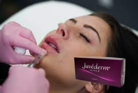 Kadın Çapraz Bağlı Hyaluronik Asit Dermal Doldurucu Juvederm Dudak Doldurucu Ultra 3 Ultra 4