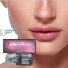 Hyaluronik Asit Dermal Dolgu Dudak Enjeksiyonları Juvederm Ultra3 Ultra4 Voluma