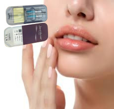 2 X 1 ml Juvederm Ultra 4 Enjekte edilebilir Dermal Filler Dudak Filler Enjeksiyonları