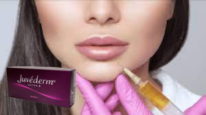 Juvederm Ultra 3 Hyaluronik Asit HA Dermal Filler 2ml Dudak Büyütücü