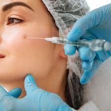 Yumuşak kırışıklıklar Enjekte edilebilir Dermal Dolgu Hialuronik Asit Juvederm Ultra 3 2*1ml